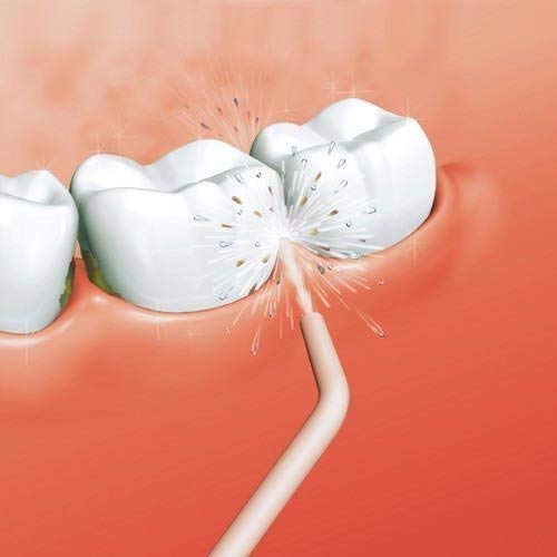 Power Floss Teeth Cleaner1 Power Floss Teeth Cleaner1